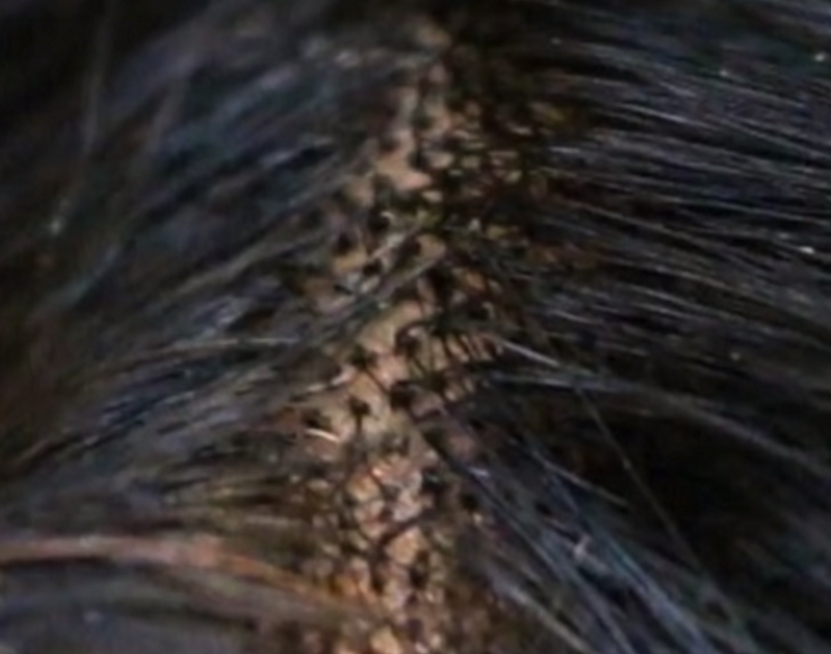 BIG KNOTS! Why Do They Exist?